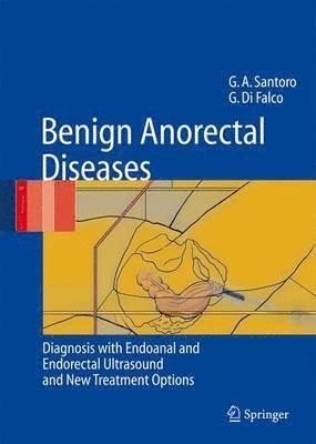 Giulio Aniello Santoro, Giuseppe Di Falco - Benign Anorectal Diseases, Inbunden