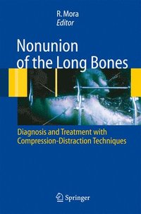 bokomslag Nonunion of the Long Bones