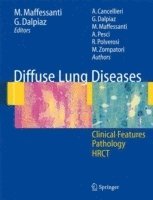 bokomslag Diffuse Lung Diseases