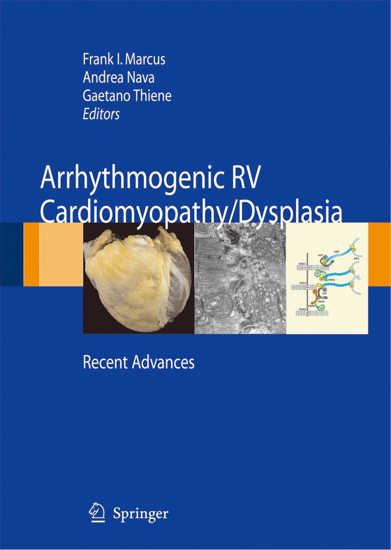 Frank I. Marcus, Andrea Nava, Gaetano Thiene - Arrhythmogenic RV Cardiomyopathy/Dysplasia, Inbunden