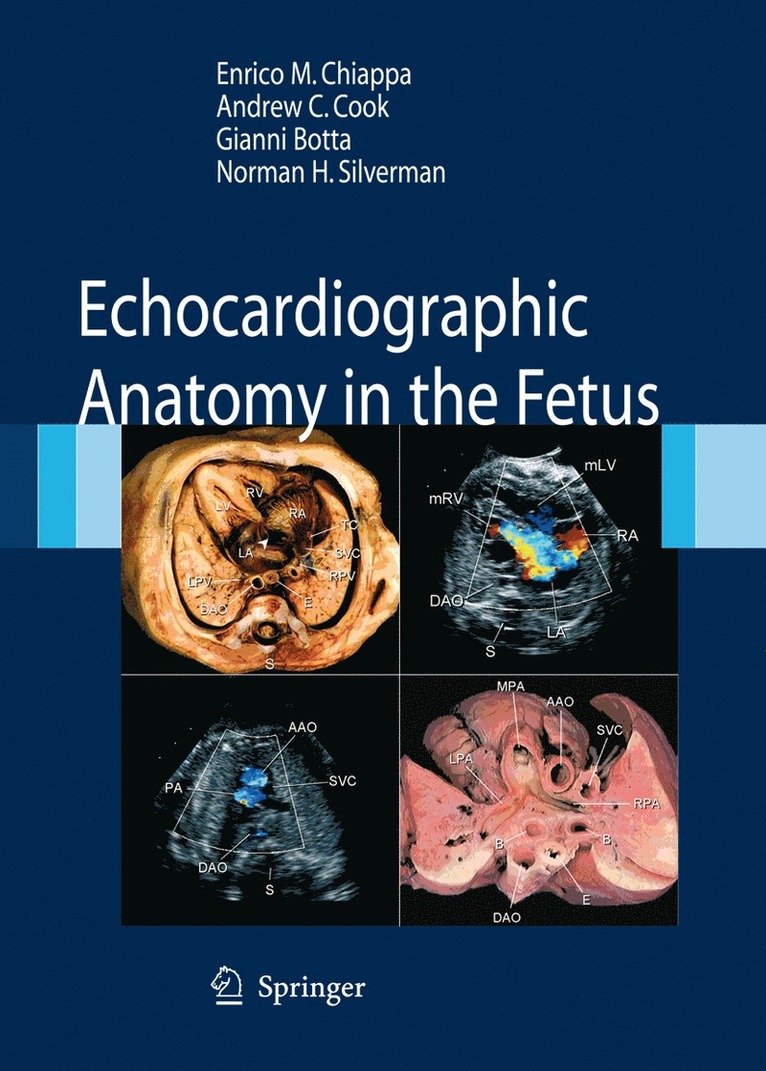 Enrico Chiappa, Andrew C. Cook, Gianni Botta, Norman H. Silverman, Andrew C Cook, Norman H Silverman - Echocardiographic Anatomy in the Fetus, Inbunden