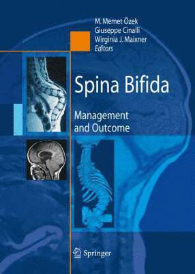M. Memet Özek, Giuseppe Cinalli, Wirginia Maixner, M. Memet Ozek - Spina Bifida, Inbunden