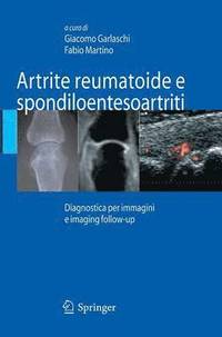 bokomslag Artrite reumatoide e spondiloentesoartriti