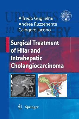 Surgical Treatment of Hilar and Intrahepatic Cholangiocarcinoma 1