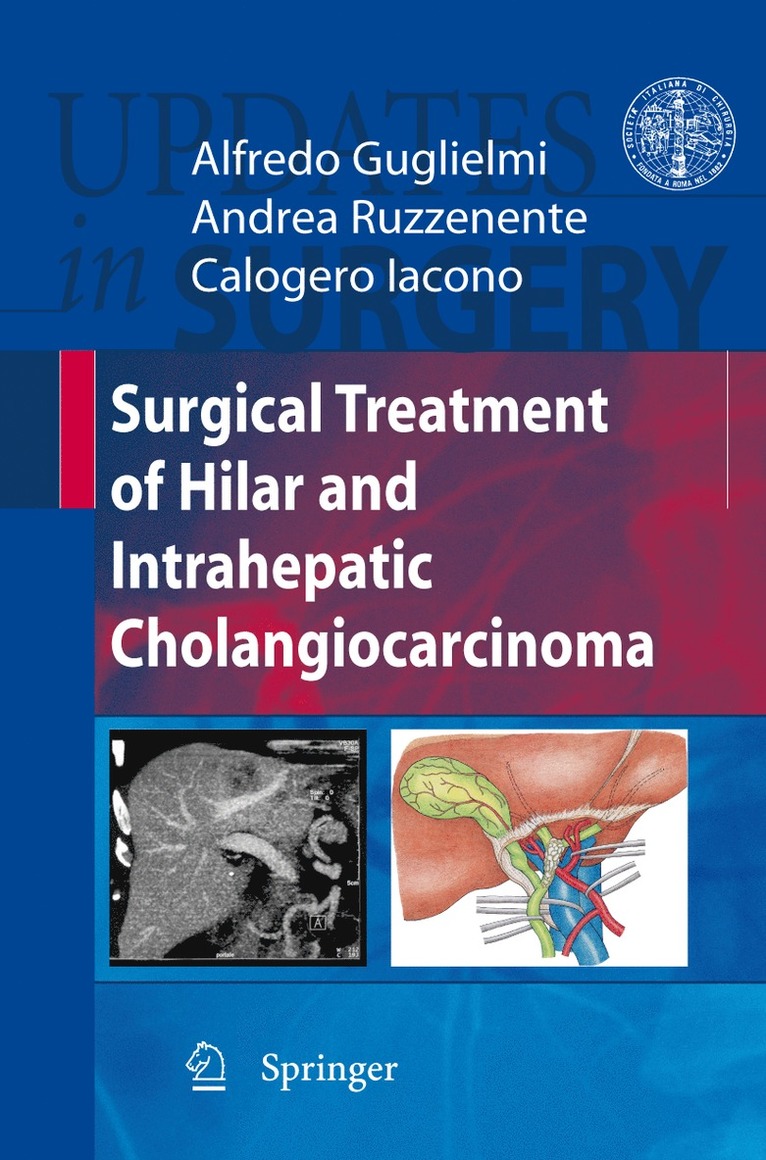 Alfredo Guglielmi, Andrea Ruzzenente, Calogero Iacono - Surgical Treatment of Hilar and Intrahepatic Cholangiocarcinoma, Häftad
