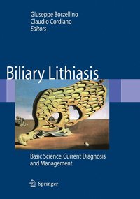 bokomslag Biliary Lithiasis