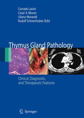 Corrado Lavini, Cesar A. Moran, Uliano Morandi, Rudolf Schoenhuber - Thymus Gland Pathology, Häftad