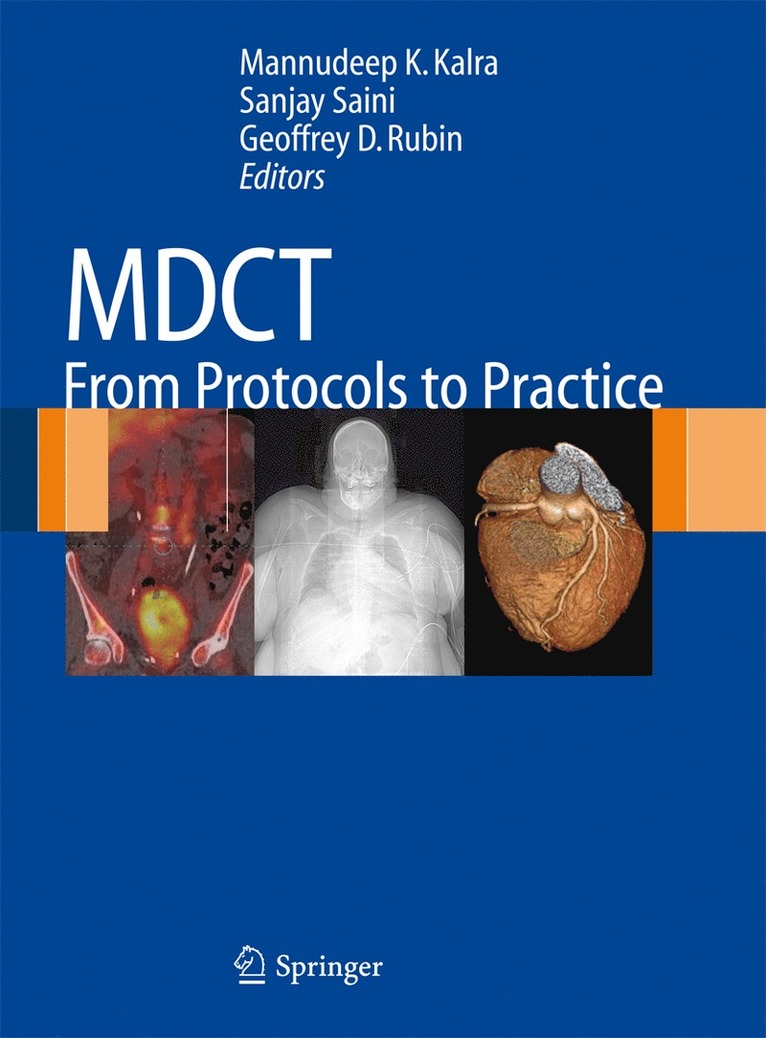 MDCT