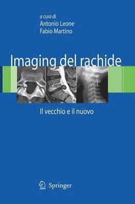 bokomslag Imaging del rachide