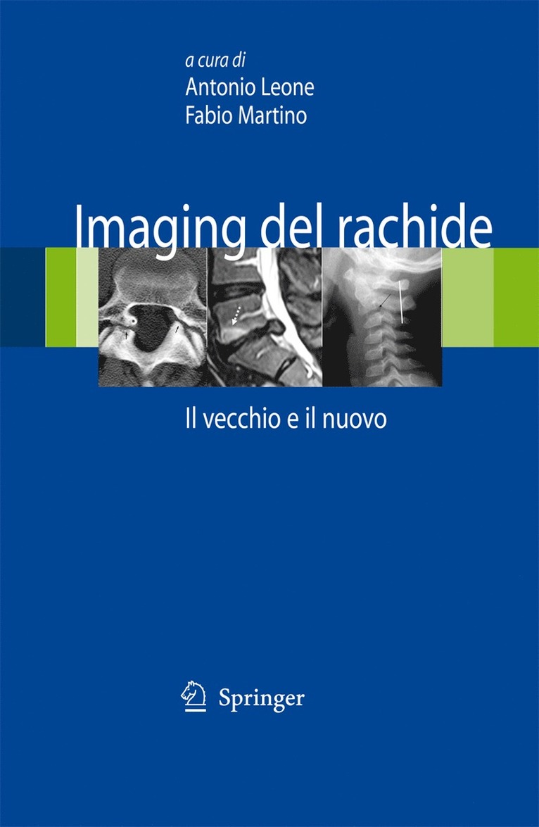 Antonio Leone, Fabio Martino - Imaging del rachide, Inbunden