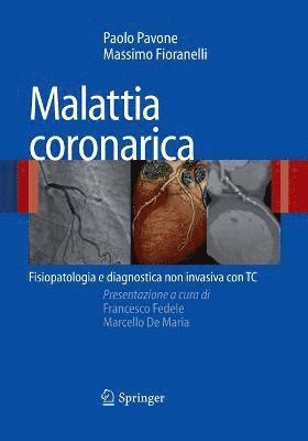 bokomslag Malattia coronarica