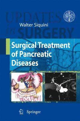 Surgical Treatment of Pancreatic Diseases 1