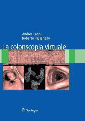 La colonscopia virtuale 1