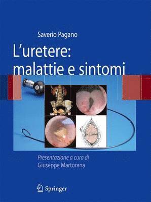 Saverio Pagano - L'uretere: malattie e sintomi, Häftad