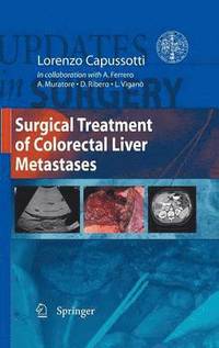 bokomslag Surgical Treatment of Colorectal Liver Metastases