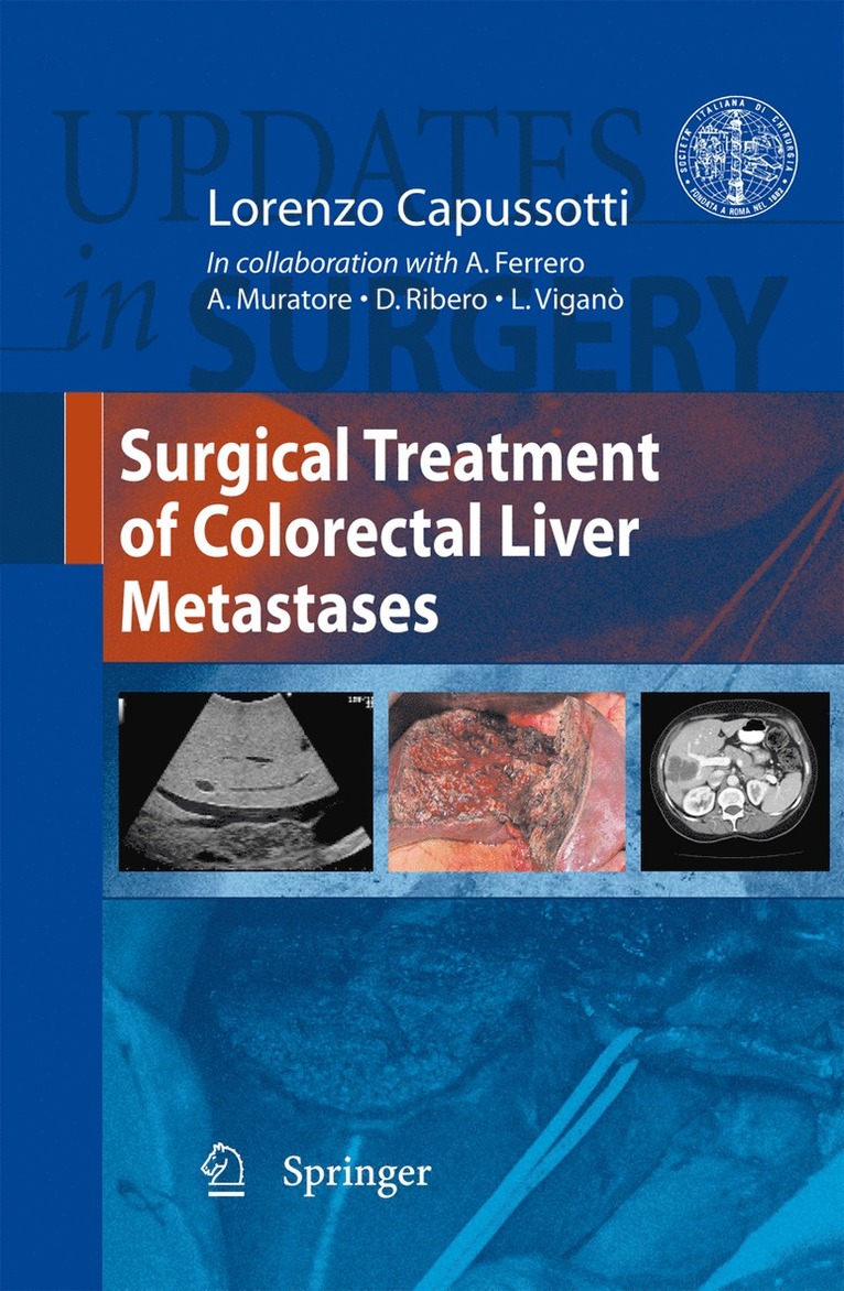 Lorenzo Capussotti - Surgical Treatment of Colorectal Liver Metastases, Inbunden