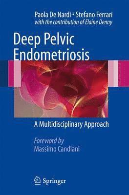 Deep Pelvic Endometriosis 1