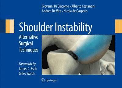 Shoulder Instability 1