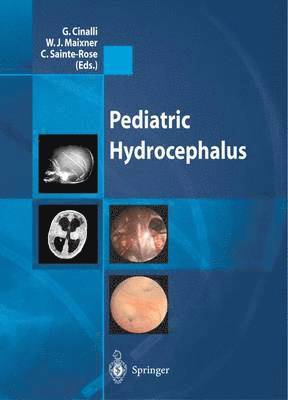 Pediatric Hydrocephalus 1