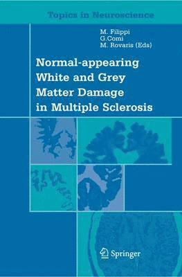 Normal-appearing White and Grey Matter Damage in Multiple Sclerosis 1