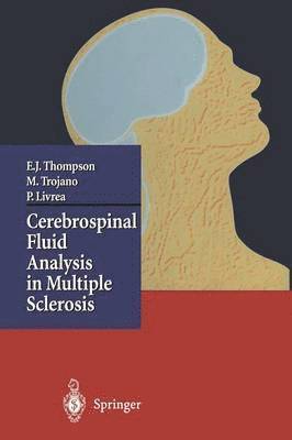 Cerebrospinal Fluid Analysis in Multiple Sclerosis 1