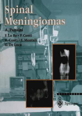 A. Pansini, F. Lo Re, P. Conti, E. Montali, G- De Luca, G. De Luca - Spinal Meningiomas, Häftad