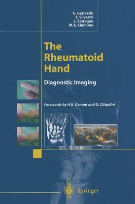 bokomslag The Rheumatoid Hand