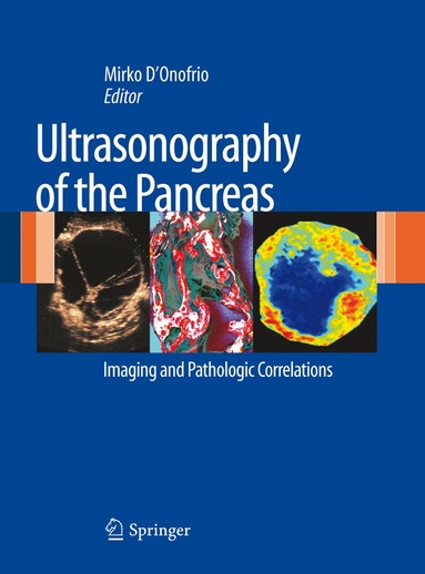 bokomslag Ultrasonography of the Pancreas