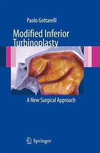 bokomslag Modified Inferior Turbinoplasty