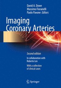 bokomslag Imaging Coronary Arteries