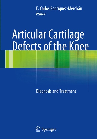 E. Carlos Rodrìguez-Merchán - Articular Cartilage Defects of the Knee, Inbunden