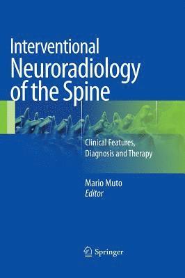 bokomslag Interventional Neuroradiology of the Spine