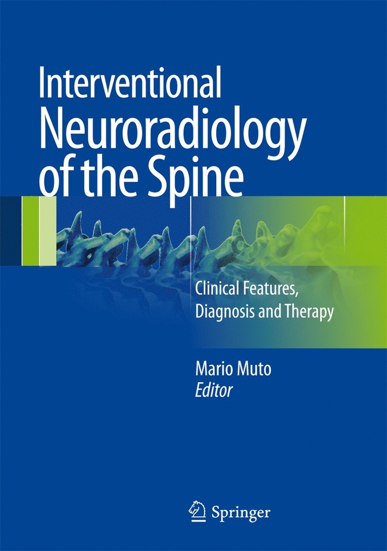 Interventional Neuroradiology of the Spine
