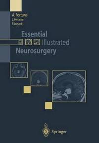 bokomslag Essential Illustrated Neurosurgery