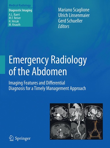 bokomslag Emergency Radiology of the Abdomen