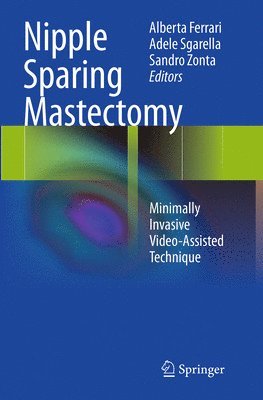 bokomslag Nipple Sparing Mastectomy