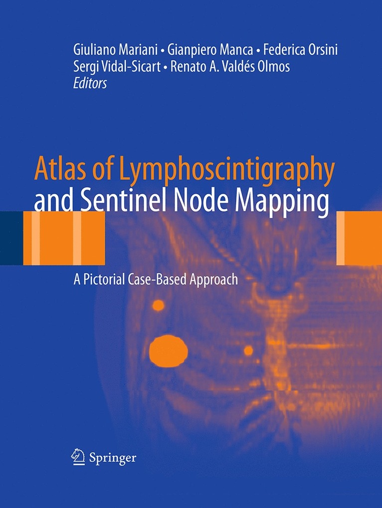 Giuliano Mariani, Gianpiero Manca, Renato A. Valdés Olmos, Renato A. Valdes Olmos - Atlas of Lymphoscintigraphy and Sentinel Node Mapping, Häftad