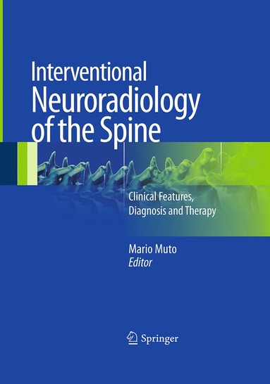 bokomslag Interventional Neuroradiology of the Spine