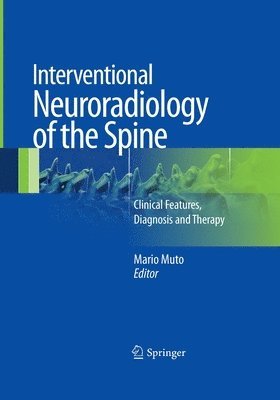 Interventional Neuroradiology of the Spine 1