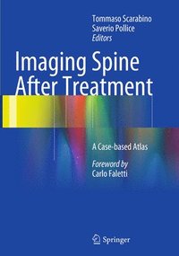 bokomslag Imaging Spine After Treatment