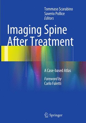 Imaging Spine After Treatment 1