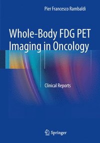 bokomslag Whole-Body FDG PET Imaging in Oncology