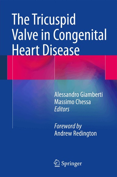 Alessandro Giamberti, Massimo Chessa - Tricuspid Valve in Congenital Heart Disease, Inbunden
