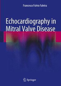 bokomslag Echocardiography in Mitral Valve Disease