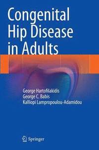 bokomslag Congenital Hip Disease in Adults
