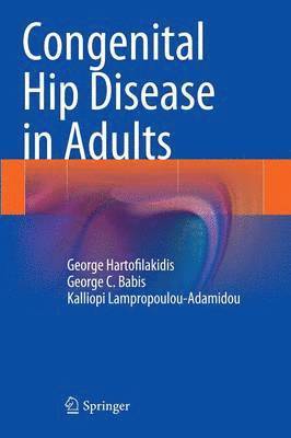 Congenital Hip Disease in Adults 1