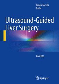 bokomslag Ultrasound-Guided Liver Surgery