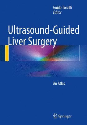 Ultrasound-Guided Liver Surgery 1