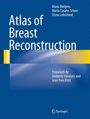 bokomslag Atlas of Breast Reconstruction