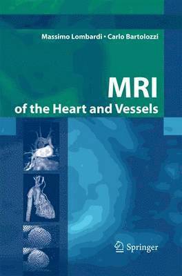 bokomslag MRI of the Heart and Vessels